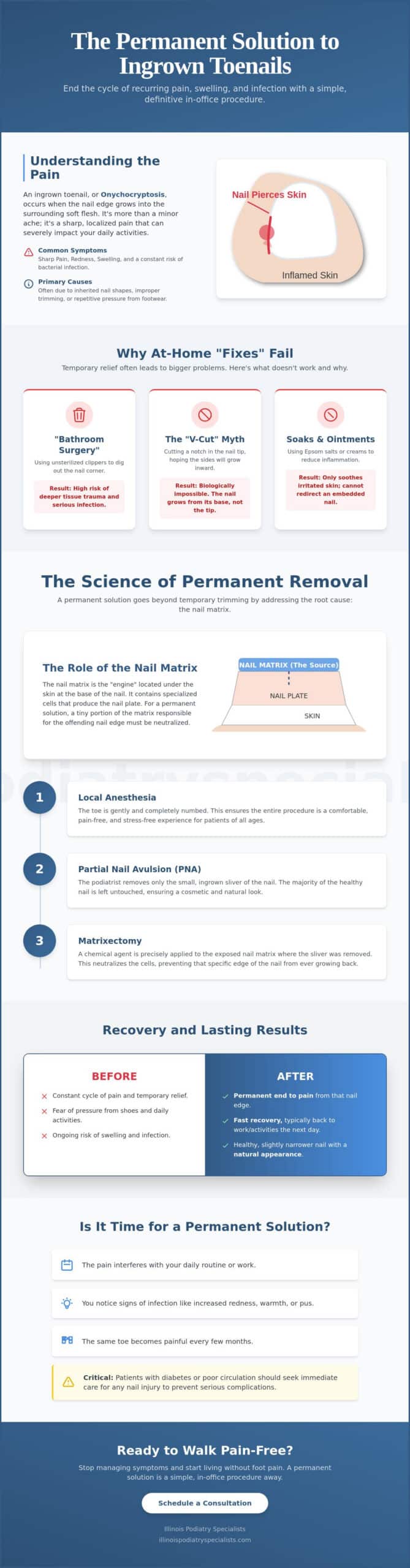 Permanent Ingrown Toenail Solution in Burr Ridge: End the Cycle of Pain